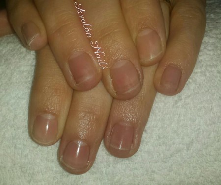 Nagels na verwijdering van gelpolish